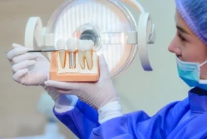 Stages of Dental Implants procedure Stages of Dental Implants procedure