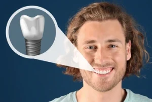 patient showing bone graft before dental implant patient showing bone graft before dental implant